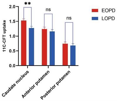 Characteristics and influencing factors of 11C-CFT PET imaging in patients with early and late onset Parkinson’s disease